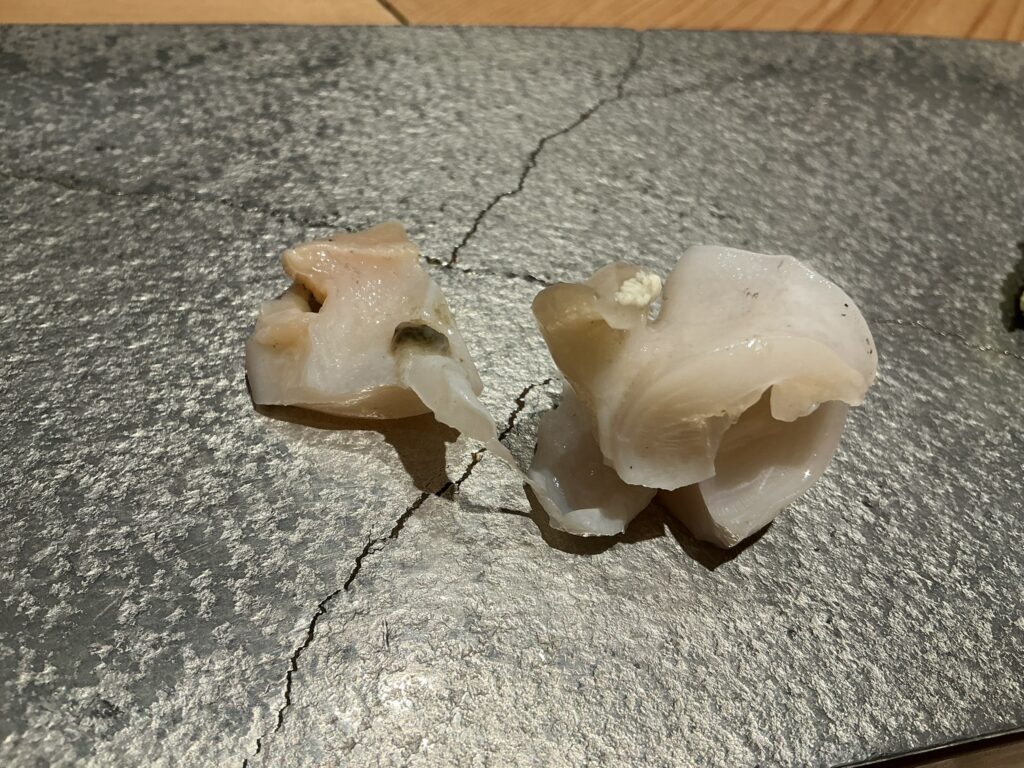 寿司栄のバイガイ